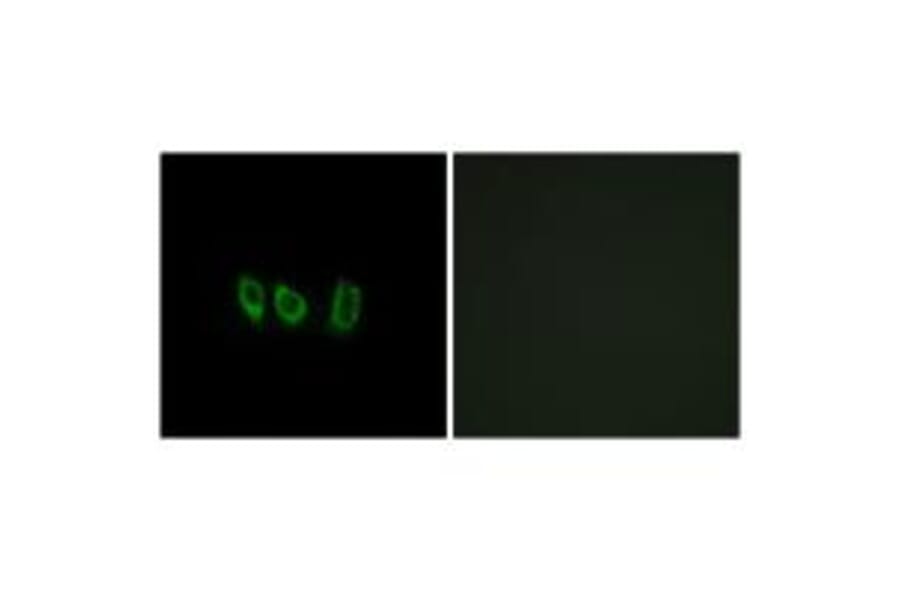 Immunofluorescence - CSTL1 Antibody from Signalway Antibody (34628) - Antibodies.com