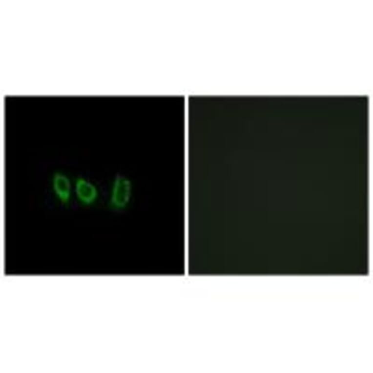 Immunofluorescence - CSTL1 Antibody from Signalway Antibody (34628) - Antibodies.com