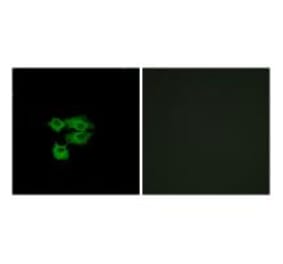 Immunofluorescence - LY6E Antibody from Signalway Antibody (34769) - Antibodies.com