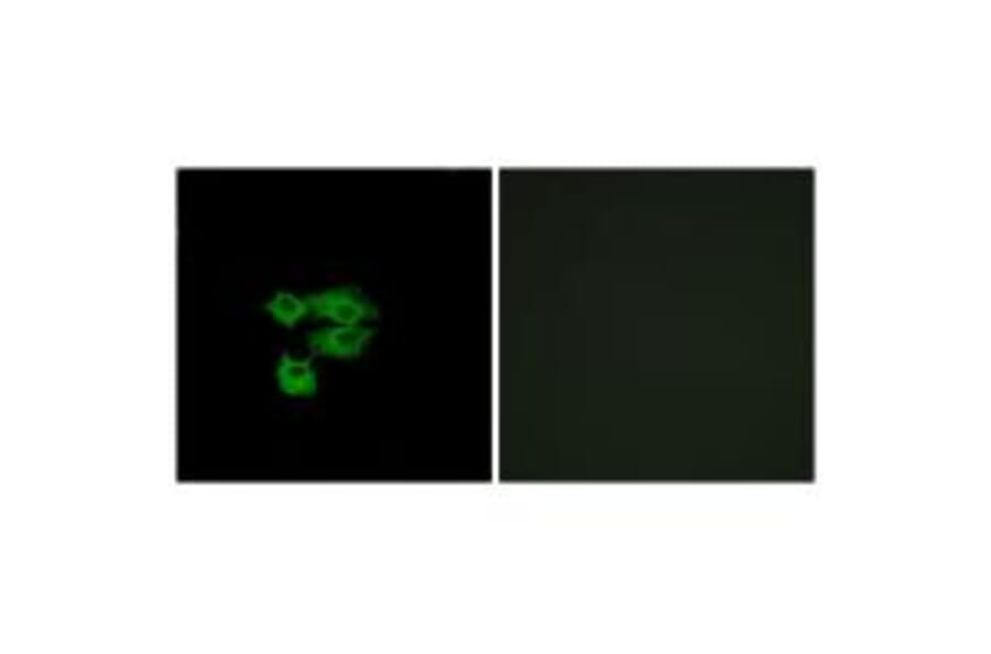 Immunofluorescence - LY6E Antibody from Signalway Antibody (34769) - Antibodies.com