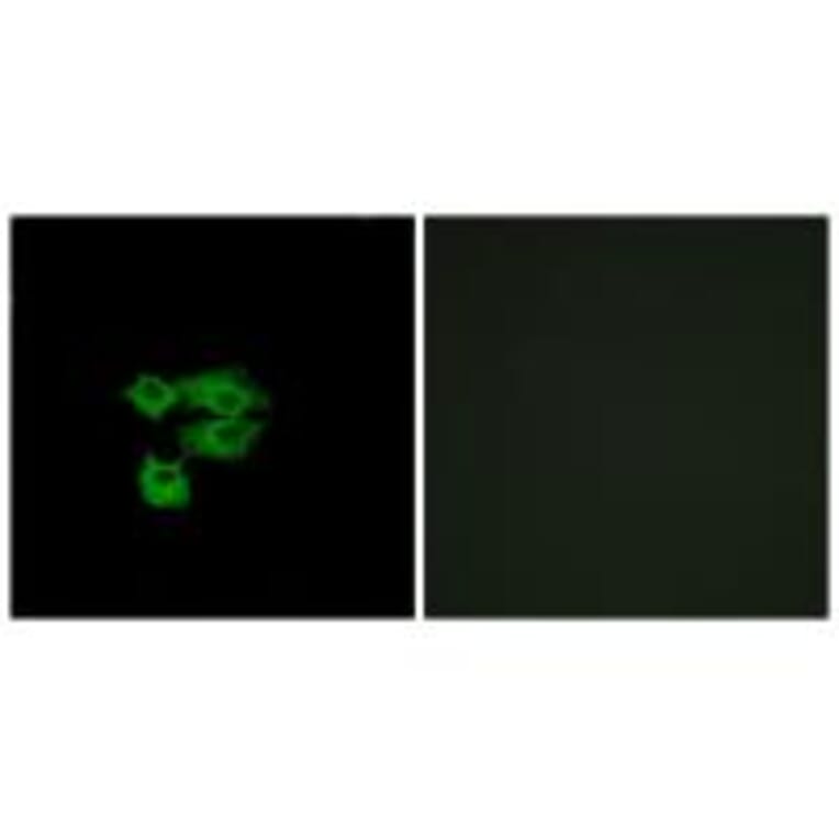 Immunofluorescence - LY6E Antibody from Signalway Antibody (34769) - Antibodies.com