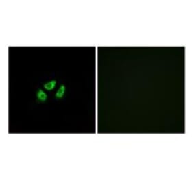 Immunofluorescence - SCN7A Antibody from Signalway Antibody (35055) - Antibodies.com