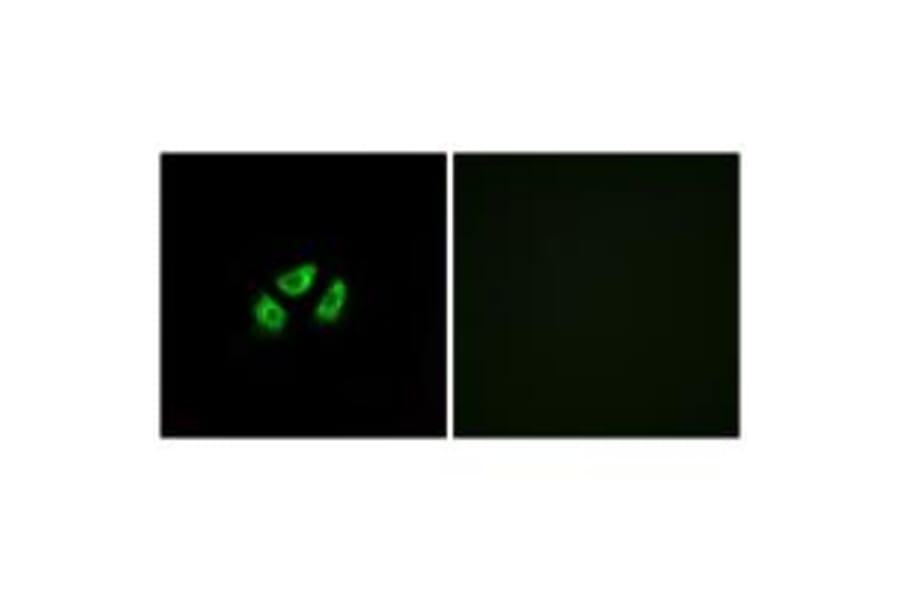 Immunofluorescence - SCN7A Antibody from Signalway Antibody (35055) - Antibodies.com