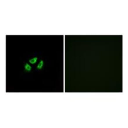 Immunofluorescence - SCN7A Antibody from Signalway Antibody (35055) - Antibodies.com