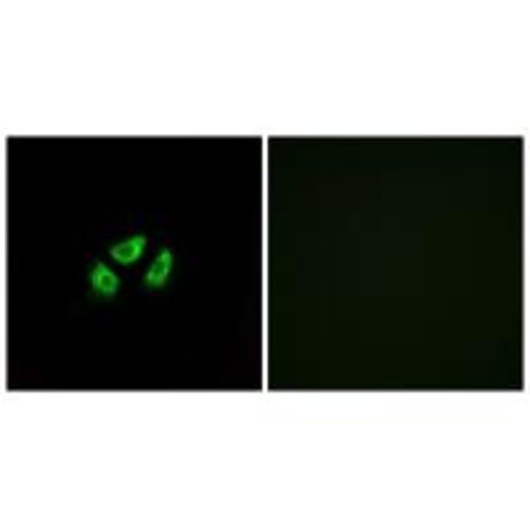 Immunofluorescence - SCN7A Antibody from Signalway Antibody (35055) - Antibodies.com