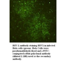 HSV-1 Antibody from Signalway Antibody (39395) - Antibodies.com