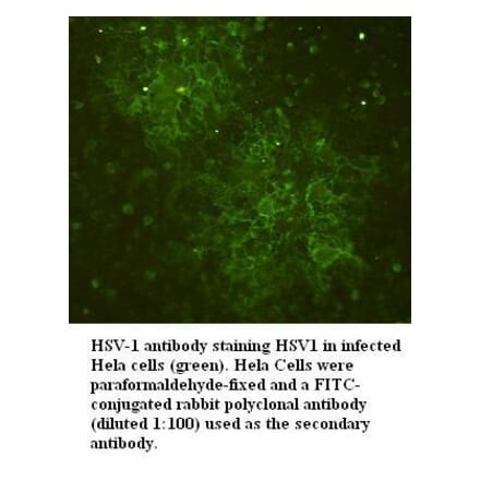 HSV-1 Antibody from Signalway Antibody (39395) - Antibodies.com