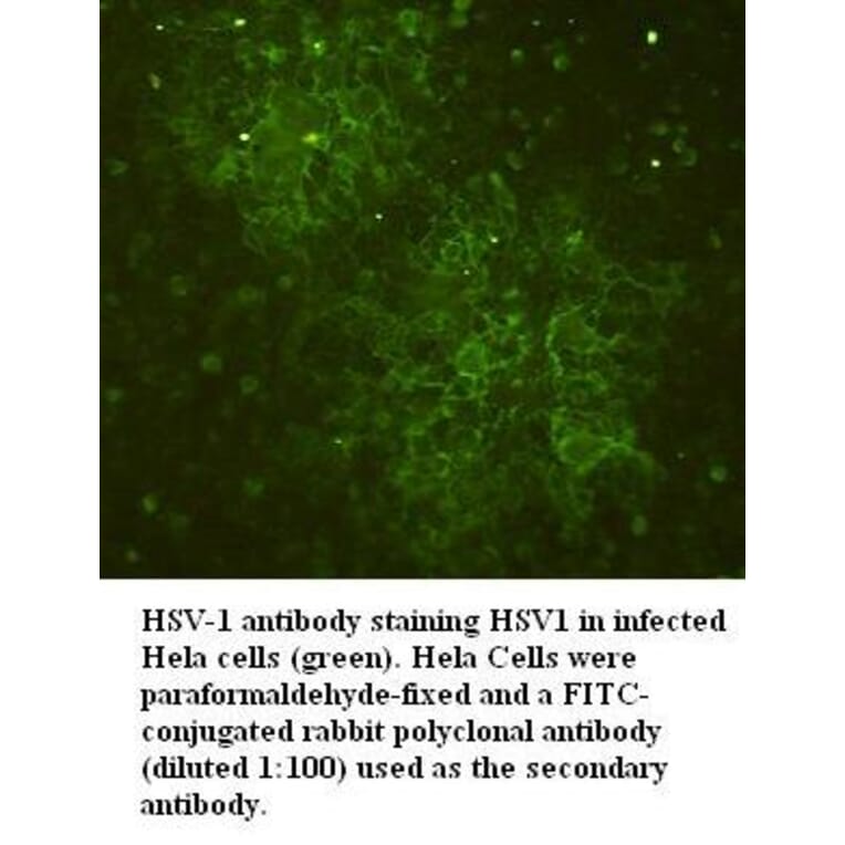 HSV-1 Antibody from Signalway Antibody (39395) - Antibodies.com