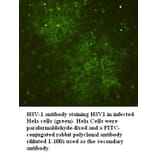 HSV-1 Antibody from Signalway Antibody (39395) - Antibodies.com