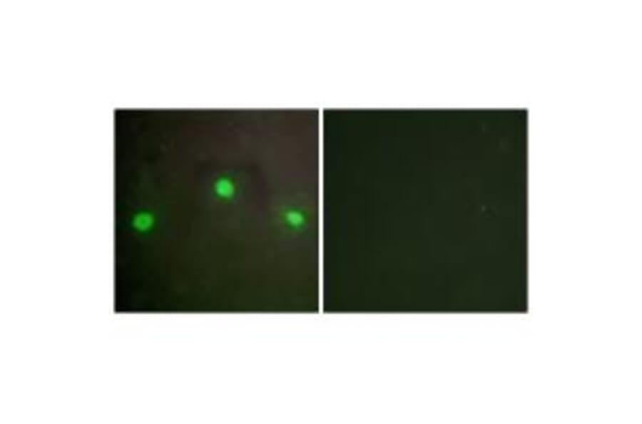 Immunofluorescence - ATRX Antibody from Signalway Antibody (33777) - Antibodies.com