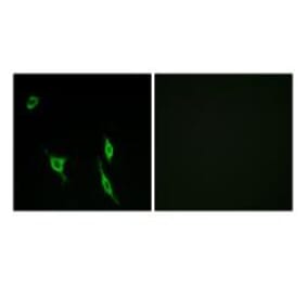 Immunofluorescence - DCC Antibody from Signalway Antibody (34265) - Antibodies.com