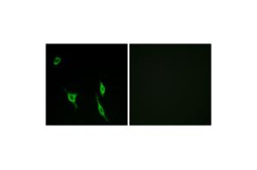 Immunofluorescence - DCC Antibody from Signalway Antibody (34265) - Antibodies.com