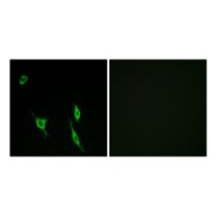 Immunofluorescence - DCC Antibody from Signalway Antibody (34265) - Antibodies.com