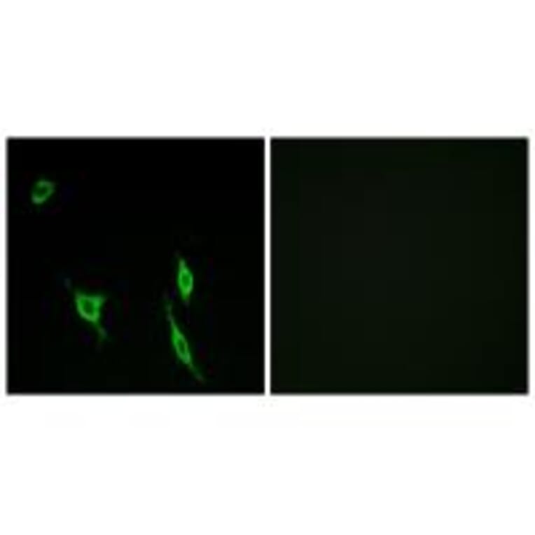 Immunofluorescence - DCC Antibody from Signalway Antibody (34265) - Antibodies.com