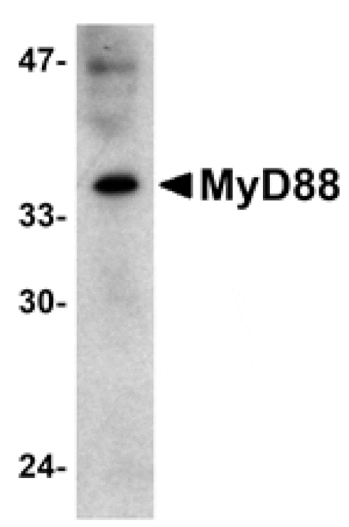 Western blot - MYD88 Antibody from Signalway Antibody (24066) - Antibodies.com