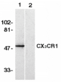 Western blot - CX3CR1 Antibody from Signalway Antibody (24056) - Antibodies.com