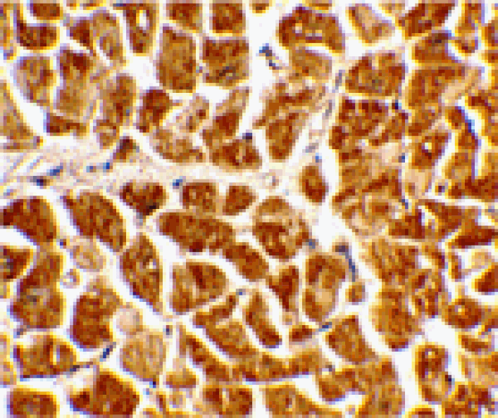 Immunohistochemistry - CX3CR1 Antibody from Signalway Antibody (24056) - Antibodies.com