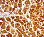 Immunohistochemistry - CX3CR1 Antibody from Signalway Antibody (24056) - Antibodies.com