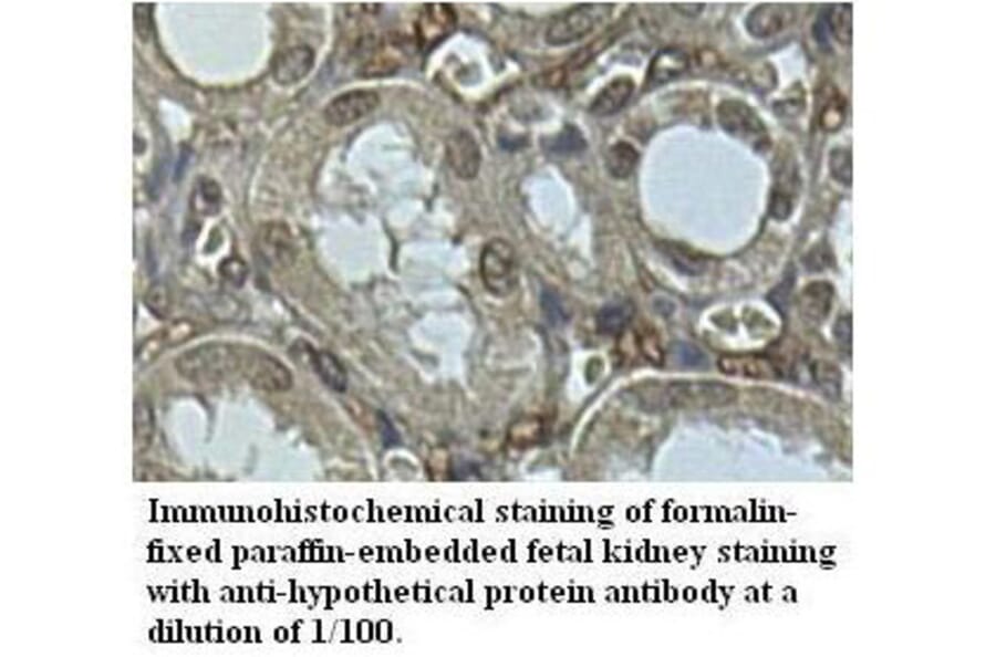 hypothetical protein Antibody from Signalway Antibody (39515) - Antibodies.com