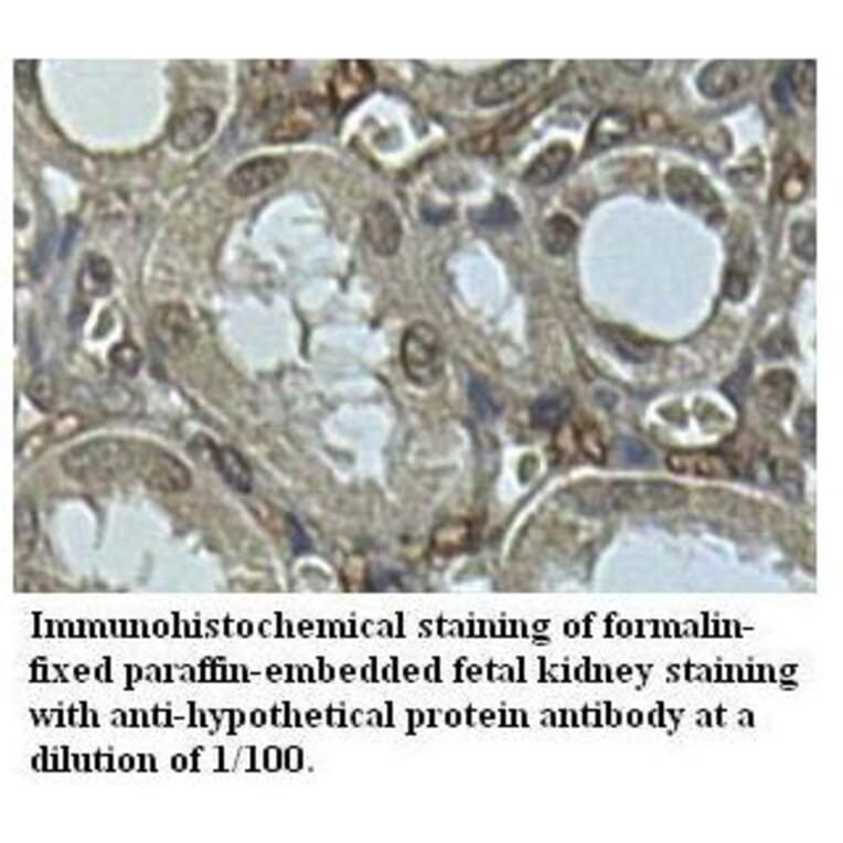 hypothetical protein Antibody from Signalway Antibody (39515) - Antibodies.com