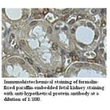 hypothetical protein Antibody from Signalway Antibody (39515) - Antibodies.com