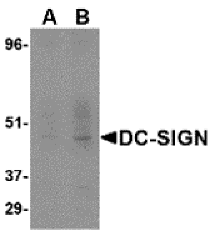 Western blot - DC-SIGN Monoclonal Antibody from Signalway Antibody (26003) - Antibodies.com