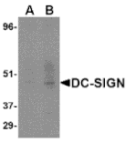 Western blot - DC-SIGN Monoclonal Antibody from Signalway Antibody (26003) - Antibodies.com