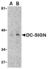 Western blot - DC-SIGN Monoclonal Antibody from Signalway Antibody (26004) - Antibodies.com