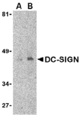 Western blot - DC-SIGN Monoclonal Antibody from Signalway Antibody (26004) - Antibodies.com