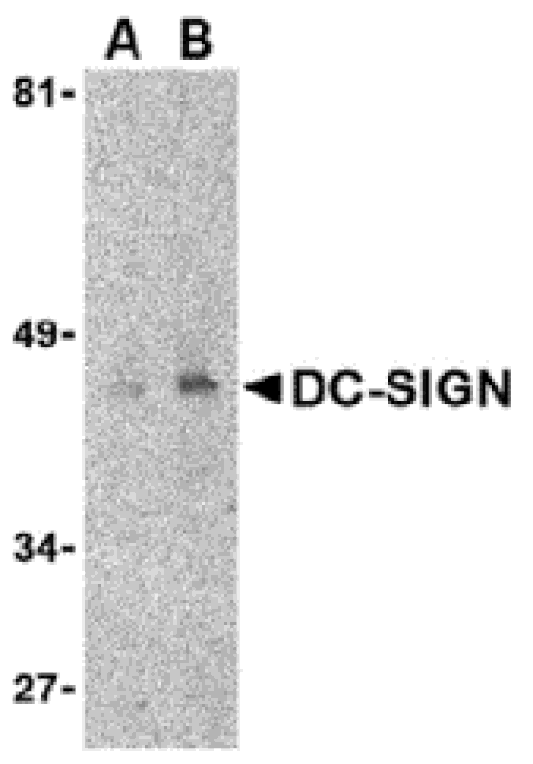 Western blot - DC-SIGN Monoclonal Antibody from Signalway Antibody (26004) - Antibodies.com