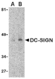 Western blot - DC-SIGN Monoclonal Antibody from Signalway Antibody (26004) - Antibodies.com