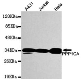 Western blot - PPP1CA Monoclonal Antibody from Signalway Antibody (27087) - Antibodies.com