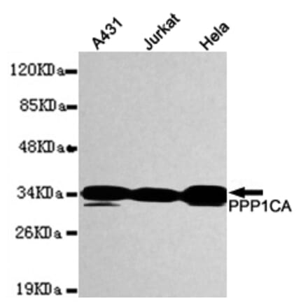 Western blot - PPP1CA Monoclonal Antibody from Signalway Antibody (27087) - Antibodies.com