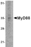 Western blot - MyD88 Monoclonal Antibody from Signalway Antibody (26020) - Antibodies.com