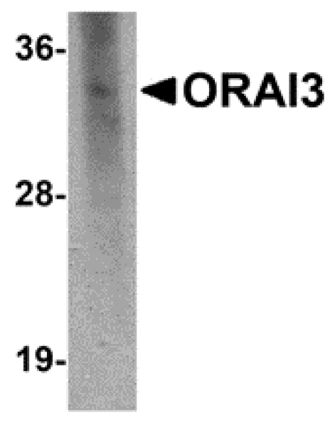 Western blot - ORAI3 Monoclonal Antibody from Signalway Antibody (26028) - Antibodies.com