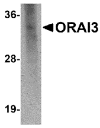 Western blot - ORAI3 Monoclonal Antibody from Signalway Antibody (26028) - Antibodies.com