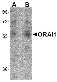 Western blot - ORAI1 Monoclonal Antibody from Signalway Antibody (26038) - Antibodies.com