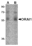 Western blot - ORAI1 Monoclonal Antibody from Signalway Antibody (26038) - Antibodies.com