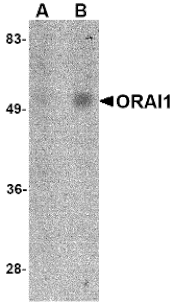 Western blot - ORAI1 Monoclonal Antibody from Signalway Antibody (26039) - Antibodies.com
