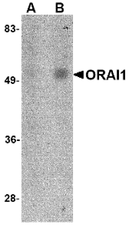 Western blot - ORAI1 Monoclonal Antibody from Signalway Antibody (26039) - Antibodies.com