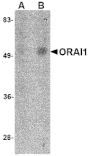 Western blot - ORAI1 Monoclonal Antibody from Signalway Antibody (26039) - Antibodies.com