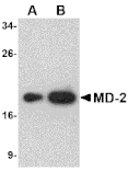 Western blot - MD-2 Monoclonal Antibody from Signalway Antibody (26027) - Antibodies.com