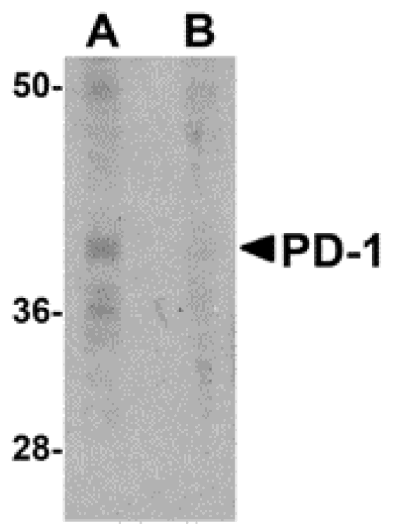 Western blot - PD-1 Monoclonal Antibody from Signalway Antibody (26034) - Antibodies.com