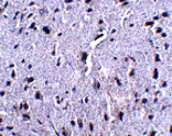 Immunohistochemistry - PD-1 Monoclonal Antibody from Signalway Antibody (26034) - Antibodies.com