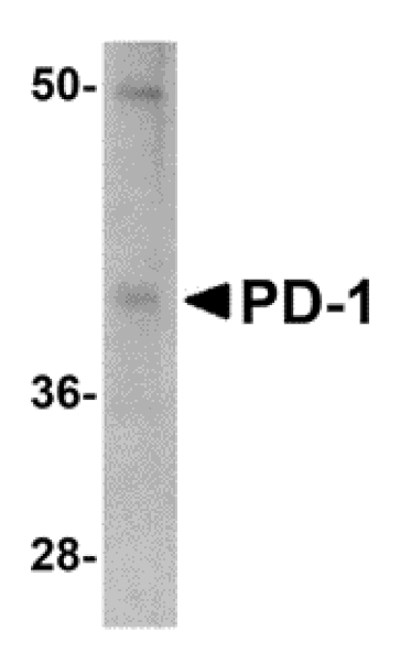 Western blot - PD-1 Monoclonal Antibody from Signalway Antibody (26035) - Antibodies.com
