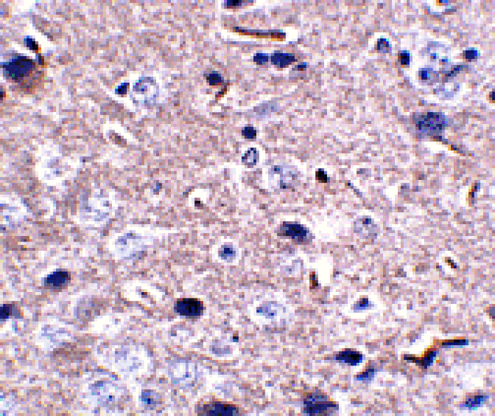 Immunohistochemistry - PD-1 Monoclonal Antibody from Signalway Antibody (26035) - Antibodies.com