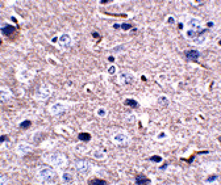 Immunohistochemistry - PD-1 Monoclonal Antibody from Signalway Antibody (26035) - Antibodies.com