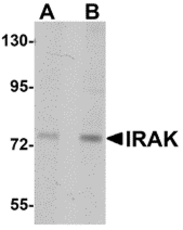 Western blot - IRAK Monoclonal Antibody from Signalway Antibody (26040) - Antibodies.com