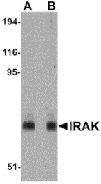 Western blot - IRAK Monoclonal Antibody from Signalway Antibody (26041) - Antibodies.com