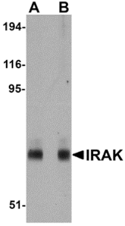 Western blot - IRAK Monoclonal Antibody from Signalway Antibody (26041) - Antibodies.com